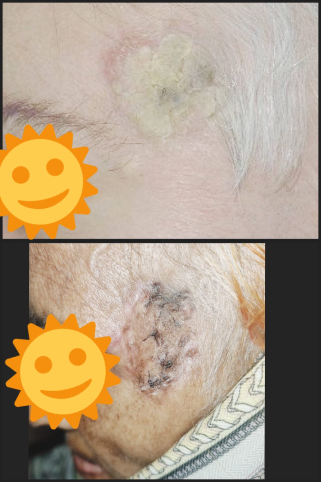 Before & After 16